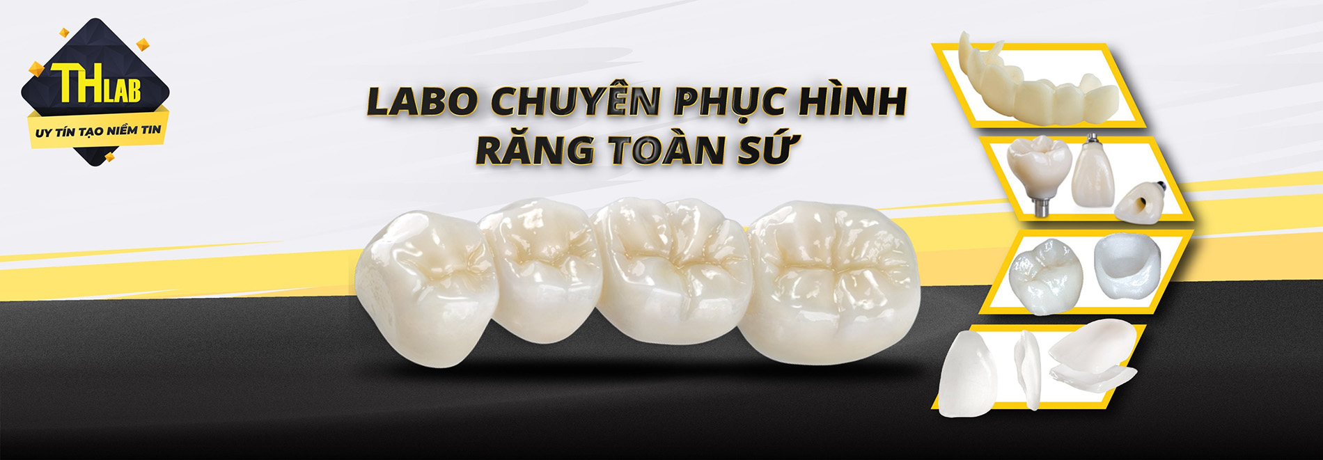 TH chuyên phục hình toàn sứ